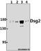 Desmoglein 2 antibody, A02035-1, Boster Biological Technology, Western Blot image 