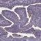 Nephrocystin 4 antibody, NBP2-39059, Novus Biologicals, Immunohistochemistry frozen image 