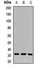 Aquaporin 10 antibody, LS-C668913, Lifespan Biosciences, Western Blot image 