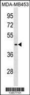 ALG8 Alpha-1,3-Glucosyltransferase antibody, 59-956, ProSci, Western Blot image 