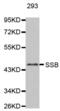 Small RNA Binding Exonuclease Protection Factor La antibody, abx000787, Abbexa, Western Blot image 