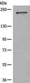 CDC42 Binding Protein Kinase Alpha antibody, PA5-68391, Invitrogen Antibodies, Western Blot image 