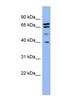 SH3 Domain Containing GRB2 Like 2, Endophilin A1 antibody, NBP1-79629, Novus Biologicals, Western Blot image 