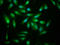 Aldehyde Dehydrogenase 7 Family Member A1 antibody, LS-C669720, Lifespan Biosciences, Immunofluorescence image 
