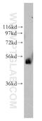 Transcription Factor AP-2 Beta antibody, 13183-1-AP, Proteintech Group, Western Blot image 