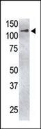 Ubiquitin Specific Peptidase 4 antibody, PA5-11996, Invitrogen Antibodies, Western Blot image 