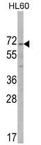 AlkB Homolog 8, TRNA Methyltransferase antibody, AP17101PU-N, Origene, Western Blot image 