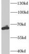 SPT7 Like, STAGA Complex Gamma Subunit antibody, FNab08396, FineTest, Western Blot image 