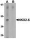 NK2 Homeobox 6 antibody, orb75738, Biorbyt, Western Blot image 