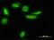 Low Density Lipoprotein Receptor Adaptor Protein 1 antibody, H00026119-M01, Novus Biologicals, Immunofluorescence image 