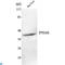 Alpha-Methylacyl-CoA Racemase antibody, LS-C813067, Lifespan Biosciences, Western Blot image 