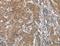 Acid Phosphatase 4 antibody, LS-C405912, Lifespan Biosciences, Immunohistochemistry frozen image 