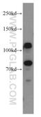 DnaJ Heat Shock Protein Family (Hsp40) Member C6 antibody, 21941-1-AP, Proteintech Group, Western Blot image 