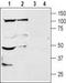 Potassium Two Pore Domain Channel Subfamily K Member 18 antibody, TA328975, Origene, Western Blot image 