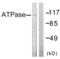 ATPase Na+/K+ Transporting Subunit Alpha 1 antibody, LS-B6994, Lifespan Biosciences, Western Blot image 