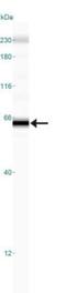 TNF Receptor Superfamily Member 10a antibody, NBP2-27350, Novus Biologicals, Western Blot image 