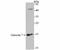 Galectin 7B antibody, A12693-2, Boster Biological Technology, Western Blot image 