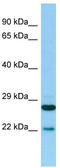 Prostaglandin E Synthase 2 antibody, TA337708, Origene, Western Blot image 