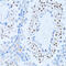Nuclear Factor Kappa B Subunit 2 antibody, 18-945, ProSci, Immunohistochemistry frozen image 