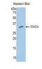 Carbonic Anhydrase 2 antibody, LS-C299252, Lifespan Biosciences, Western Blot image 