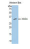 Carbonic anhydrase C antibody, LS-C299252, Lifespan Biosciences, Western Blot image 