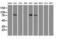 B-Raf Proto-Oncogene, Serine/Threonine Kinase antibody, LS-C784270, Lifespan Biosciences, Western Blot image 