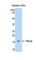 Hemoglobin Subunit Alpha 2 antibody, abx100260, Abbexa, Western Blot image 