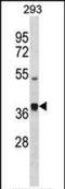 Procollagen C-Endopeptidase Enhancer 2 antibody, MBS6001650, MyBioSource, Western Blot image 