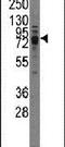 Transient Receptor Potential Cation Channel Subfamily V Member 3 antibody, PA5-11472, Invitrogen Antibodies, Western Blot image 