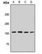 Activating signal cointegrator 1 complex subunit 3 antibody, LS-C668864, Lifespan Biosciences, Western Blot image 