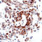 CF Transmembrane Conductance Regulator antibody, MAB1660, R&D Systems, Western Blot image 