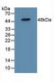 Interleukin 5 Receptor Subunit Alpha antibody, LS-C294911, Lifespan Biosciences, Western Blot image 