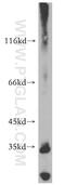 Armadillo Repeat Containing 10 antibody, 20506-1-AP, Proteintech Group, Western Blot image 