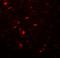 Microtubule Associated Protein 1 Light Chain 3 Beta antibody, LS-B10153, Lifespan Biosciences, Immunofluorescence image 