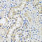 Centrin 3 antibody, 23-408, ProSci, Immunohistochemistry paraffin image 