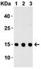 Thymic Stromal Lymphopoietin antibody, A01096-2, Boster Biological Technology, Western Blot image 