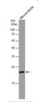 RAN, Member RAS Oncogene Family antibody, NBP1-31776, Novus Biologicals, Western Blot image 