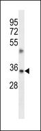 Transmembrane BAX Inhibitor Motif Containing 1 antibody, LS-C161944, Lifespan Biosciences, Western Blot image 