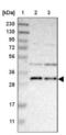 Transmembrane Protein 17 antibody, NBP1-81974, Novus Biologicals, Western Blot image 