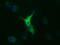 Tubulin Alpha 8 antibody, MA5-25092, Invitrogen Antibodies, Immunocytochemistry image 