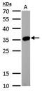 LIM Domain Binding 3 antibody, PA5-30434, Invitrogen Antibodies, Western Blot image 