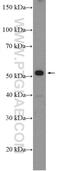 Phosphodiesterase 9A antibody, 12648-1-AP, Proteintech Group, Western Blot image 