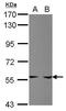 Phosphoribosyl Pyrophosphate Amidotransferase antibody, PA5-27770, Invitrogen Antibodies, Western Blot image 