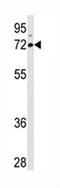 Arachidonate 15-Lipoxygenase antibody, ab80221, Abcam, Western Blot image 