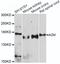 Alpha-2-Macroglobulin antibody, A1573, ABclonal Technology, Western Blot image 