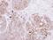 Catenin Alpha Like 1 antibody, LS-C186252, Lifespan Biosciences, Immunohistochemistry paraffin image 