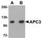 Cell Division Cycle 27 antibody, A03905, Boster Biological Technology, Western Blot image 