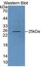 Rh Associated Glycoprotein antibody, LS-C701168, Lifespan Biosciences, Western Blot image 