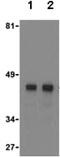 CD209 Molecule antibody, ab59192, Abcam, Western Blot image 