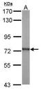 ATPase H+ Transporting V1 Subunit A antibody, GTX110815, GeneTex, Western Blot image 